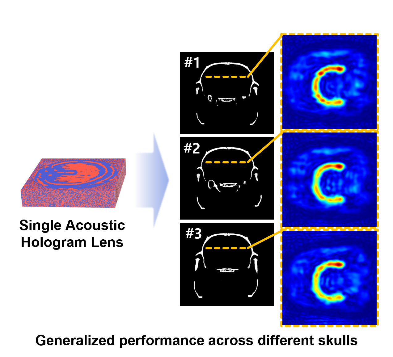 Congratulations! Accepted at IEEE T-UFFC
